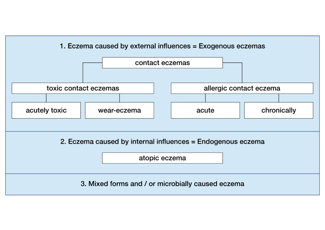 Eczema, Dermatitis - Marly Skin